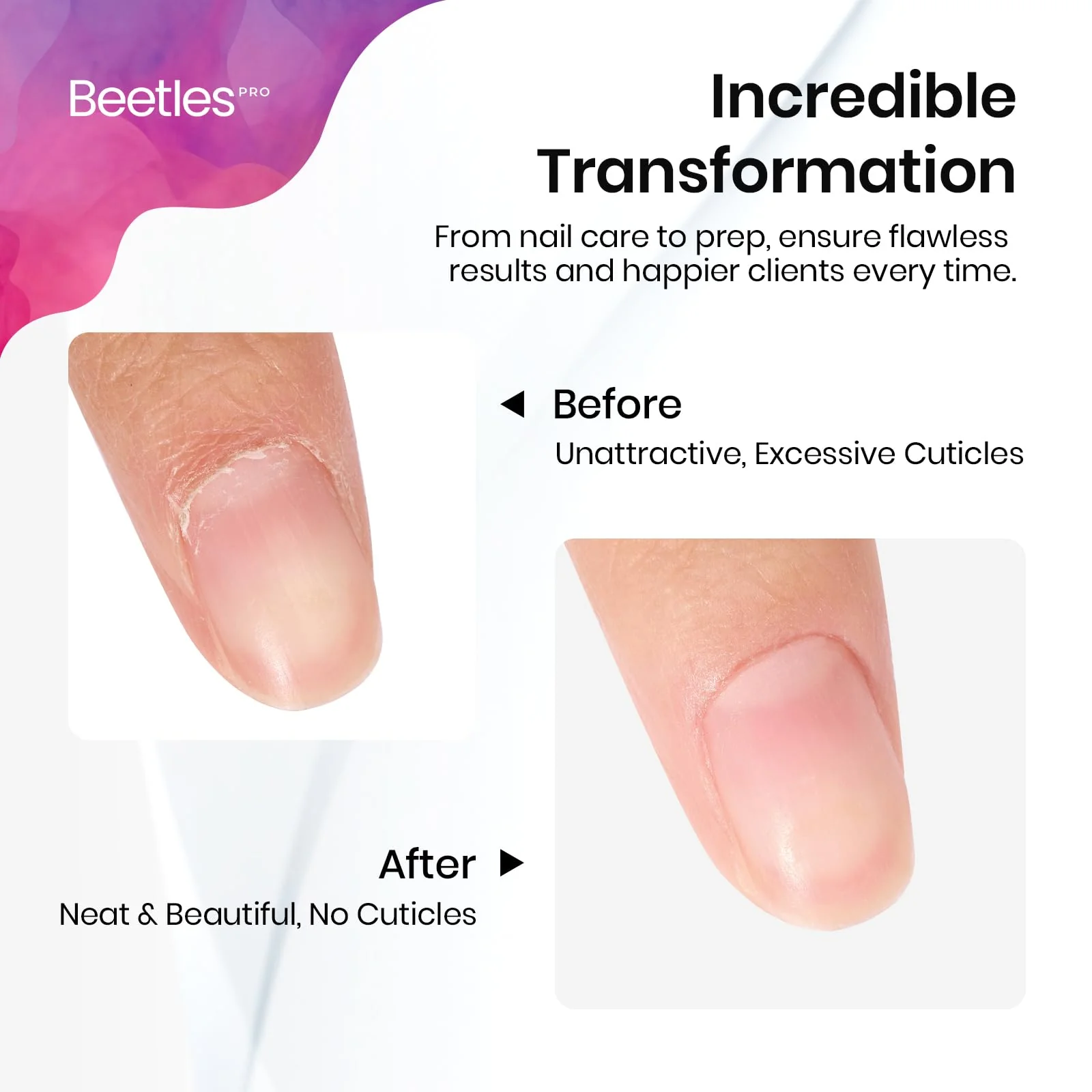 Beetles Cuticle Pusher Gel Nail Polish Remover Tool Fingernail Polish Nail Cleaner - Image 6